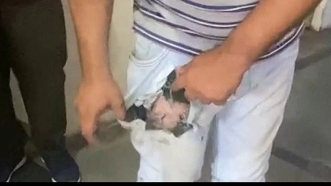 जींस की जेब में रखा मोबाइल फटा और लग गई आग, युवक के हाथ-पैर झुलसे, ले जाना पड़ा अस्पताल