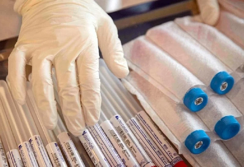 अगर आपने कोरोना वैक्सीन लगाने के पहले या बाद में पी है शराब तो हो जाए सावधान, हो सकता है ये नुकसान