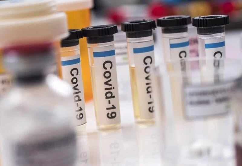 Pune Municipal Corporation orders 1L COVID-19 antigen kits for ₹4.5 cr