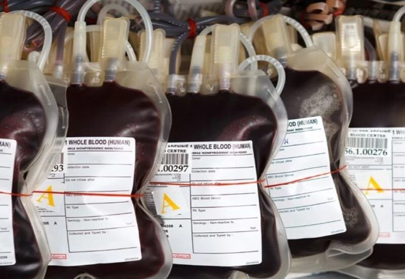 Scientists have done miracles ... now you will not have to struggle for blood, know how