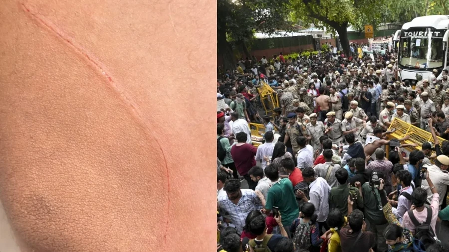 जंतर मंतर पर प्रदर्शन के दौरान CAPF जवान पर चाकू से हमला, NSUI कार्यकर्ता पर आरोप