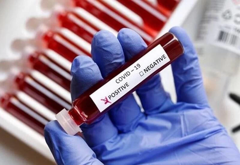 COVID-19 +ve report no longer mandatory for admission in COVID facilities: Govt