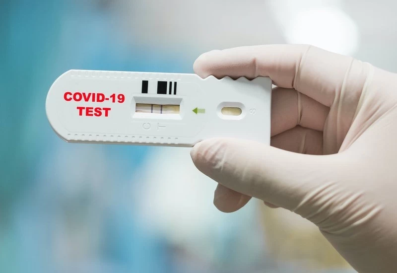 We've become 1st state to conduct over 2 cr COVID-19 tests: UP govt