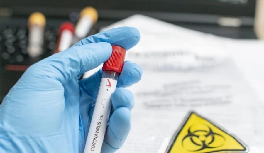 संक्रमित मिलने के 30 दिनों के अंदर खुदकुशी को कोविड-19 से हुई मौत माना जाएगा: केंद्र