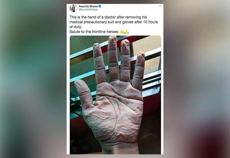 IAS officer shares pic of doctor's wrinkled hand on removing gloves after 10-hr duty