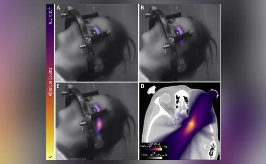 Light flashing from human eyes caught on camera for first time