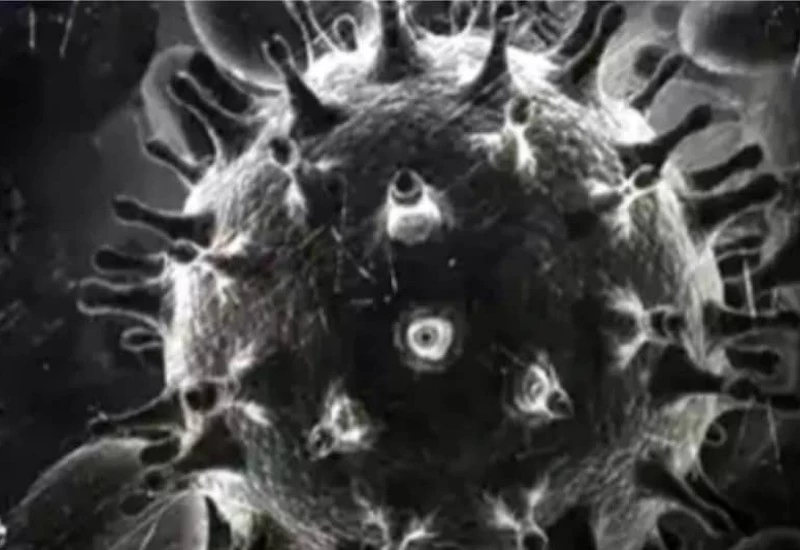 A black fungus bigger than a cricket ball was removed from the head, successful operation at IGIMS, Patna