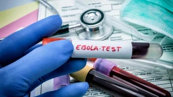 Rajasthan Ebola Alert: Suspected Case Found in Jaipur Woman from Uganda