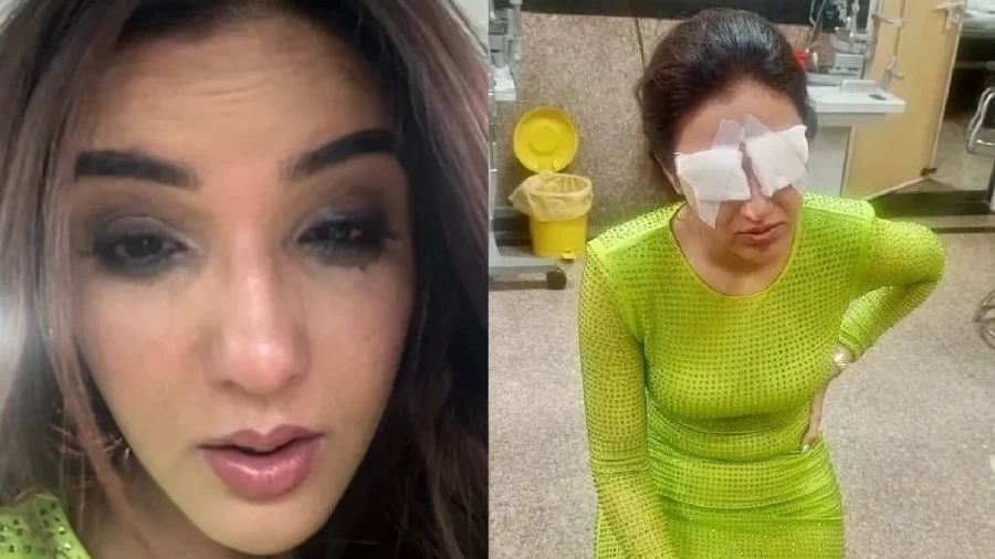 This was the condition of Jasmine just before she stopped being visible, she had to take support while walking