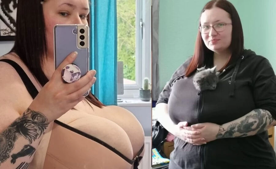 British Women with heavy breasts raising funds online for breast