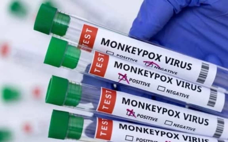 Man tests positive for monkeypox HIV and covid at the same time