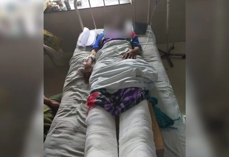 Ex-boyfriend vandalized the girl with friends, cut off her toes and heels