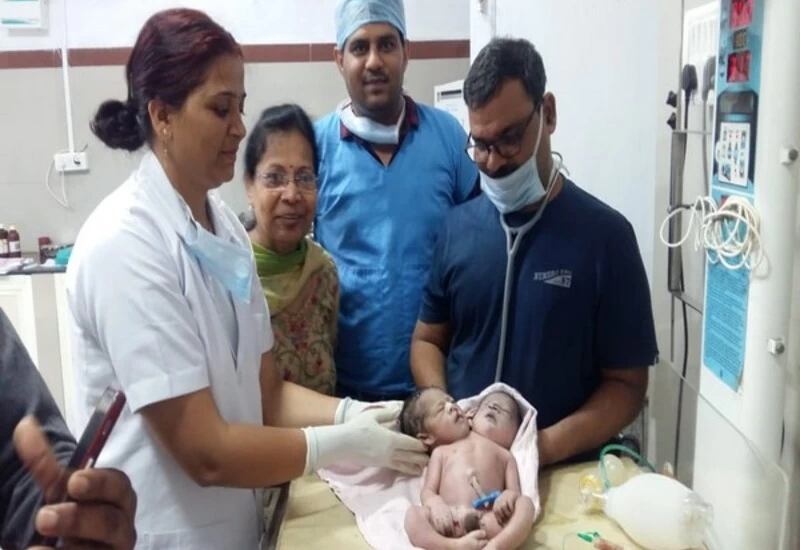 मध्यप्रदेश में 21 वर्ष की महिला ने 2 सिर 3 हाथ वाले नवजात बच्चे को दिया जन्म