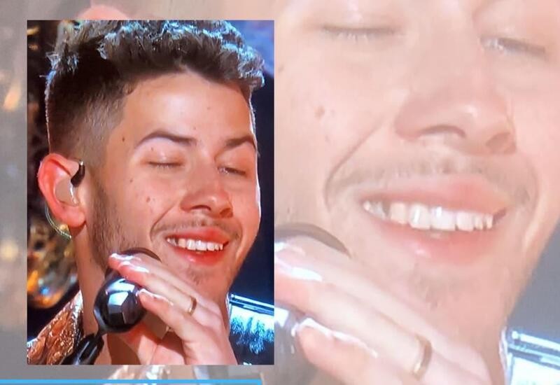 Nick trolled over 'spinach' in teeth while performing at Grammys, Watch(01)