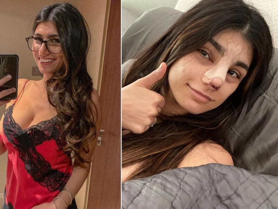 पोर्नस्टार मिया खलीफा ने करवाई अपने खास अंग की सर्जरी, अब ऐसा नजर आता है लुक