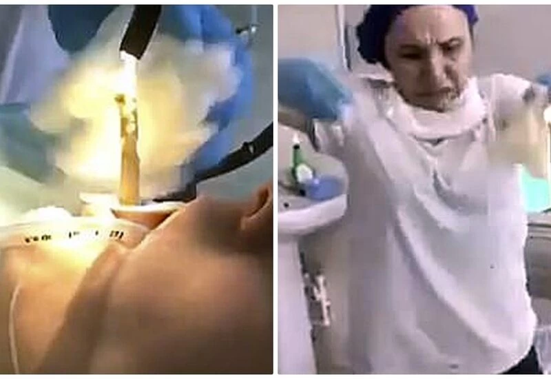 रूस में डॉक्टरों ने महिला के मुंह से 4 फीट लंबा सांप निकाला