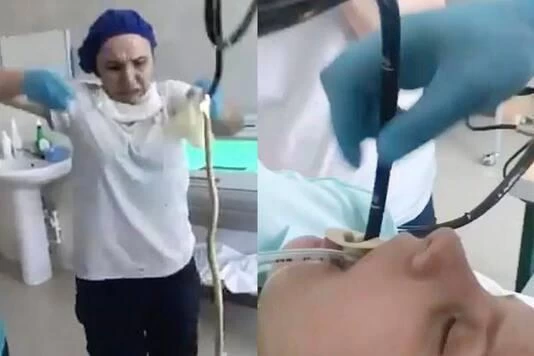 Doctors pull 4-foot snake out of woman's mouth in Russia