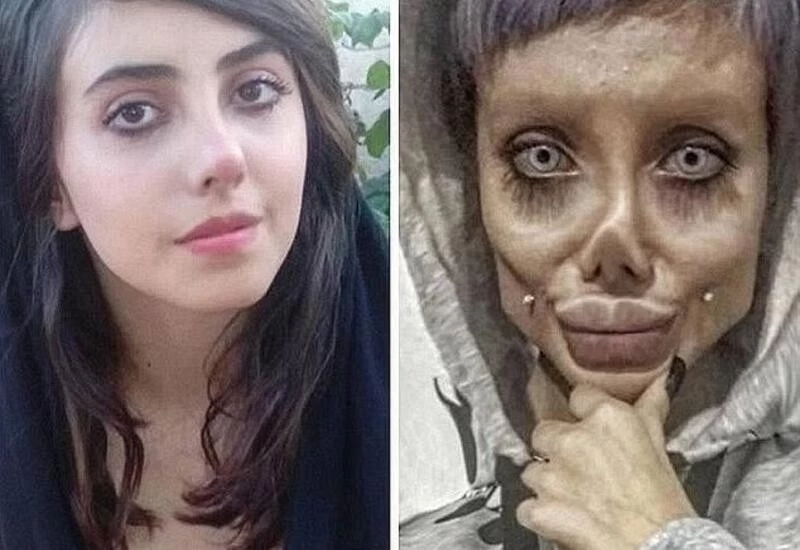22-yr-old Iranian who underwent surgeries to look like Jolie catches COVID-19 in jail