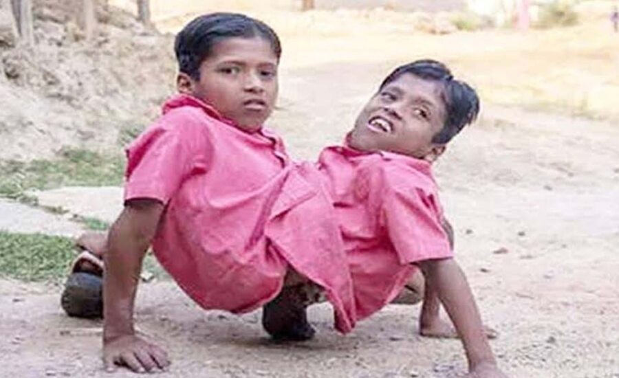 Twins brothers Shivram and Shivnath died in Chhattisgarh, last viral video create death mystery