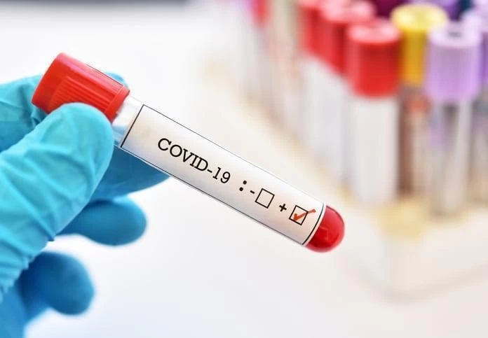 First case of Omicron variant of Covid-19 confirmed in Sri Lanka