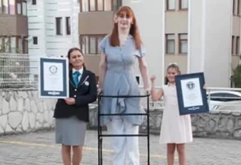 tallest living woman of world rumeysa gelgi of turkey